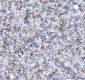 Anti-beta Catenin CTNNB1 Rabbit Monoclonal Antibody